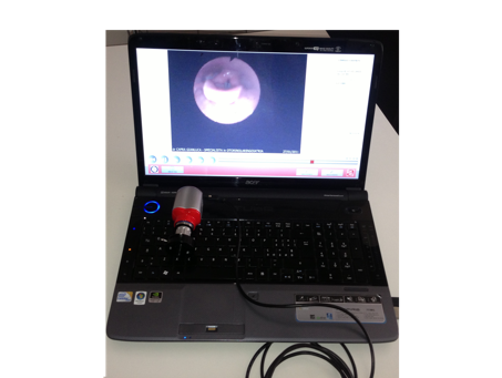 Endoscopia nasale e laringea 2